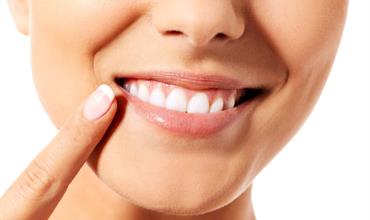 استفاده از لاک سفیدکننده دندان؛ مزایا و عوارض آن
